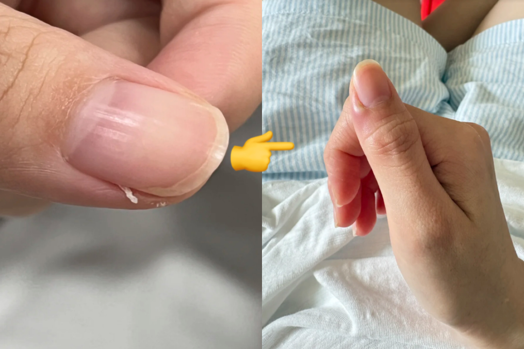 手上没有月牙,就是体虚?别被指甲传言骗了
