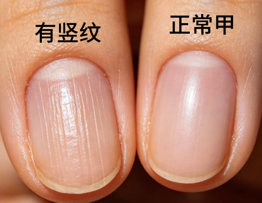 手上没有月牙,就是体虚?别被指甲传言骗了