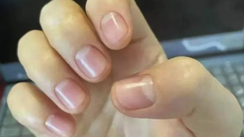 手上没有月牙，就是体虚？别被指甲传言骗了