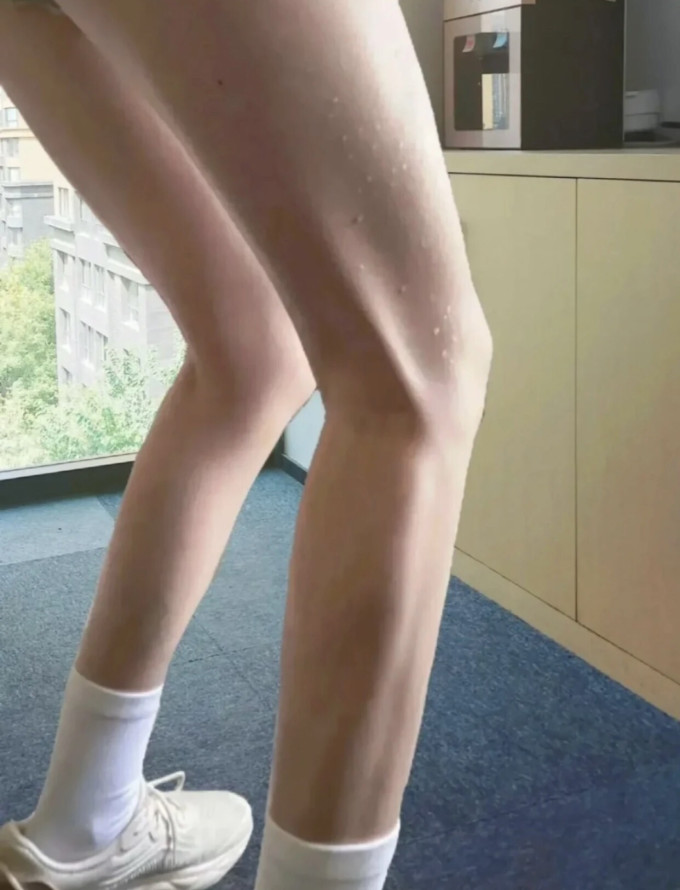跳绳