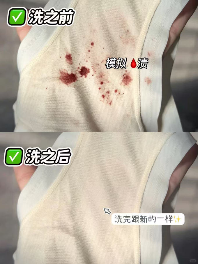 衣物清洁