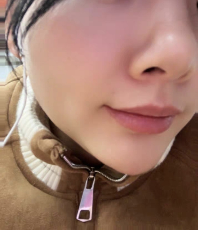 护肤精华