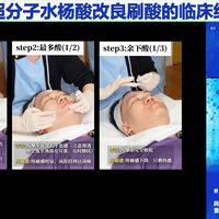 刷酸避坑、分型修护 | 成分党8.18日报