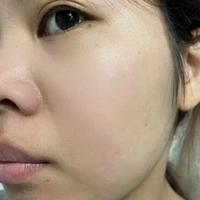 避开酒精香精就安全了？敏感肌护肤最大的坑，多数人还在踩