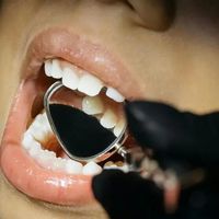 刷了牙、洗了牙、体检全绿灯，口臭却阴魂不散？门诊里太多人白跑了