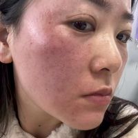 脸一红就敷面膜？急救修复护肤品怎么选？5款热门修护产品扒完