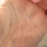 私处护理液加云母是营销噱头吗？皮肤科医生教你选对产品不踩坑