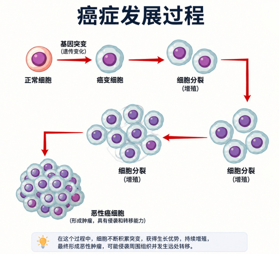 AI 开始改写癌症治疗,真相是什么?