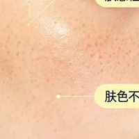屏障受损的5个预警信号：皮肤开始求救了！！