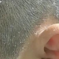 高温厨房工作者头屑多又出油，4款去油去屑洗发水抄作业