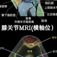 41岁白领练瑜伽，双膝半月板三度撕裂上热搜：瑜伽不坏，但这几种练法真的毁膝盖