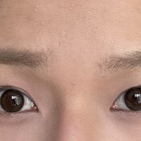 10万赞的"美瞳滑片"视频吓到不少人：镜片不会滑"进眼里"，但滑片从来不是偶然的