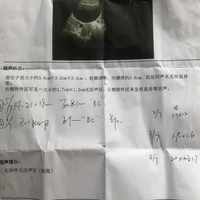 从1元试纸到医院B超：备孕排卵监测的完整决策链，大多数人花钱花错了顺序