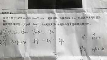 从1元试纸到医院B超：备孕排卵监测的完整决策链，大多数人花钱花错了顺序