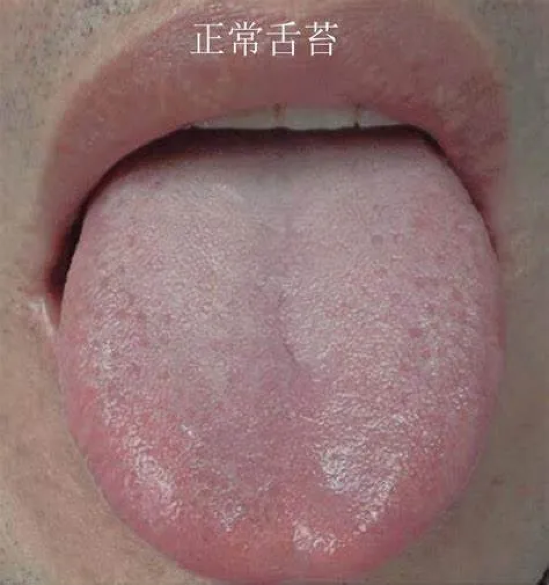 同事一张嘴“滂臭”!自己闻不到、别人不敢说的口臭有救吗?