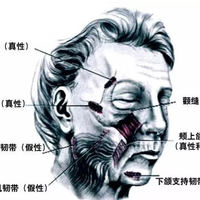 29万赞说「练背治垮脸」，1.9万赞打假：练背到底能救哪种垮脸？