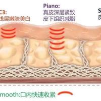 Fotona 4D是智商税吗？读完全网几十条真实体验，我发现“没效果”的人都栽在同样4个坑