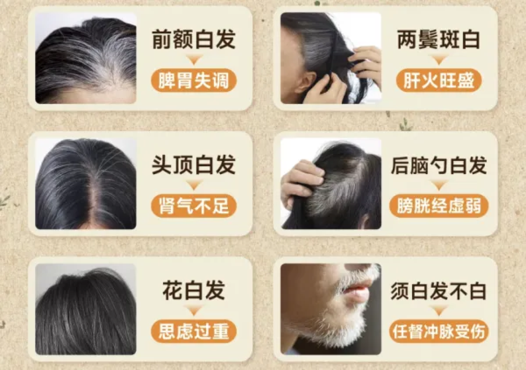 从李逍遥到现在,时间改变了什么?30岁后白发为何来得猝不及防