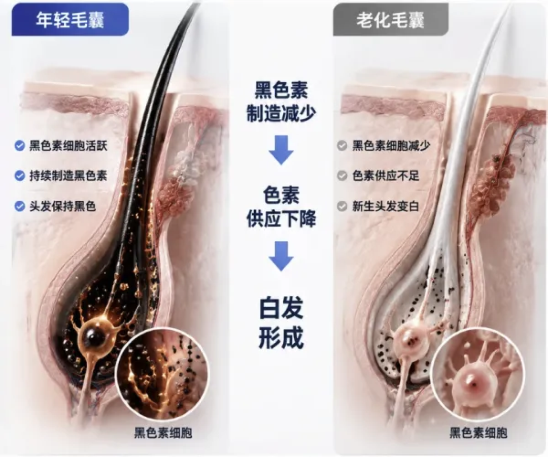 从李逍遥到现在,时间改变了什么?30岁后白发为何来得猝不及防