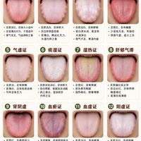 12种常见舌象快速识别