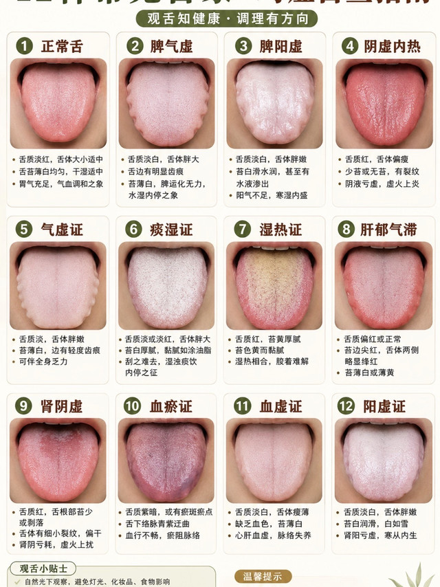12种常见舌象快速识别