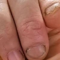 你的手，比你的脸先老10年：4种糙手，第3档必须去医院