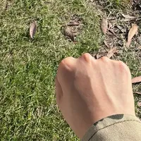 晒黑后急着买美白?我对了一遍3.8万收藏的"白回来"笔记和《日晒伤诊疗指南》:前72小时先忍住