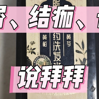 头屑、结痂、长痘折腾我N年：最后被一瓶中药洗发水捞上岸！