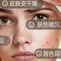 压力大导致长痘痘怎么调节情绪？