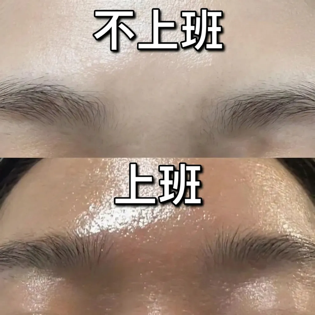 终于找到脸上疯狂出油的原因