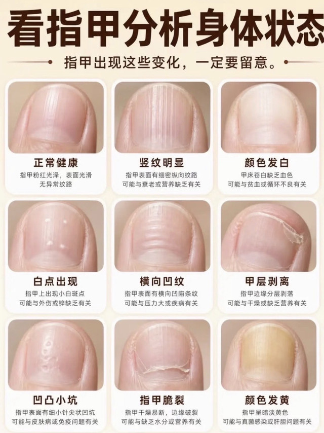 看指甲读懂身体信号💅指甲状态自查