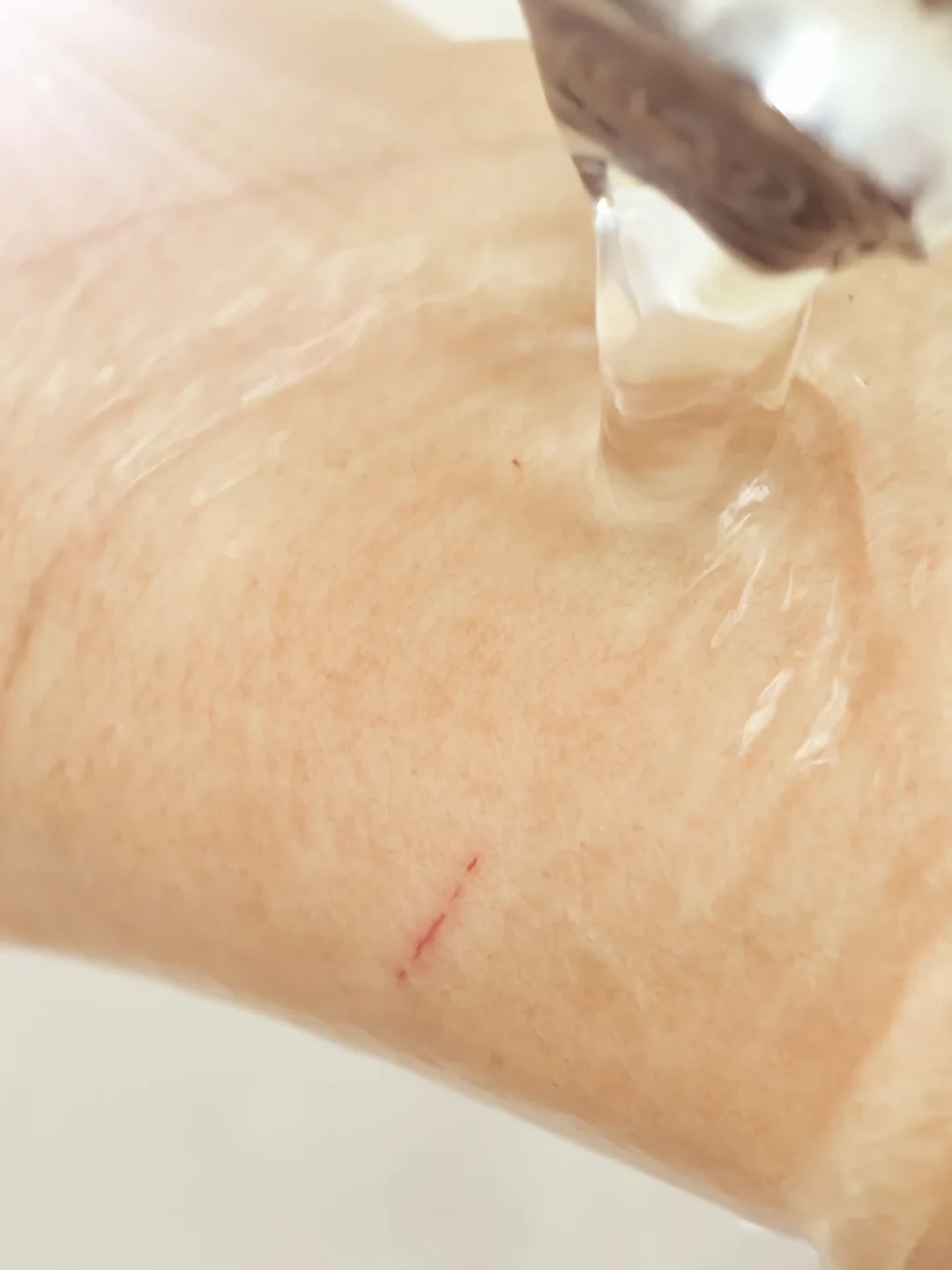被舔一下就算三级暴露,全套针2000元:被自家猫狗抓咬到底打不打?养宠家庭决策指南