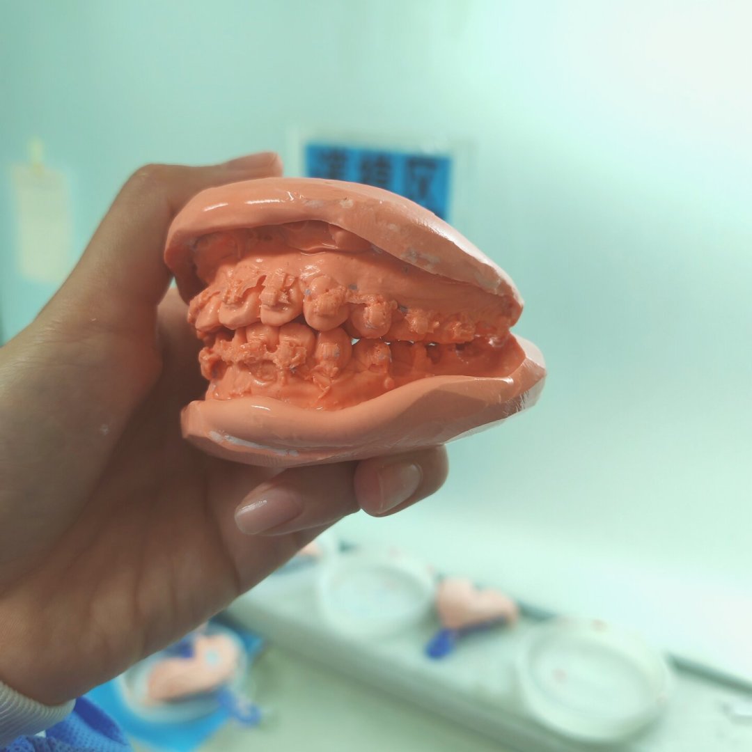 暑假只剩两周:娃的正畸哪些情况等不了、哪些不用赶、开学前能走到哪一步