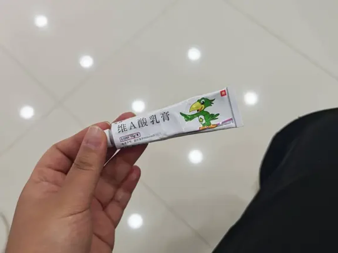 几块钱的炉甘石成颈纹