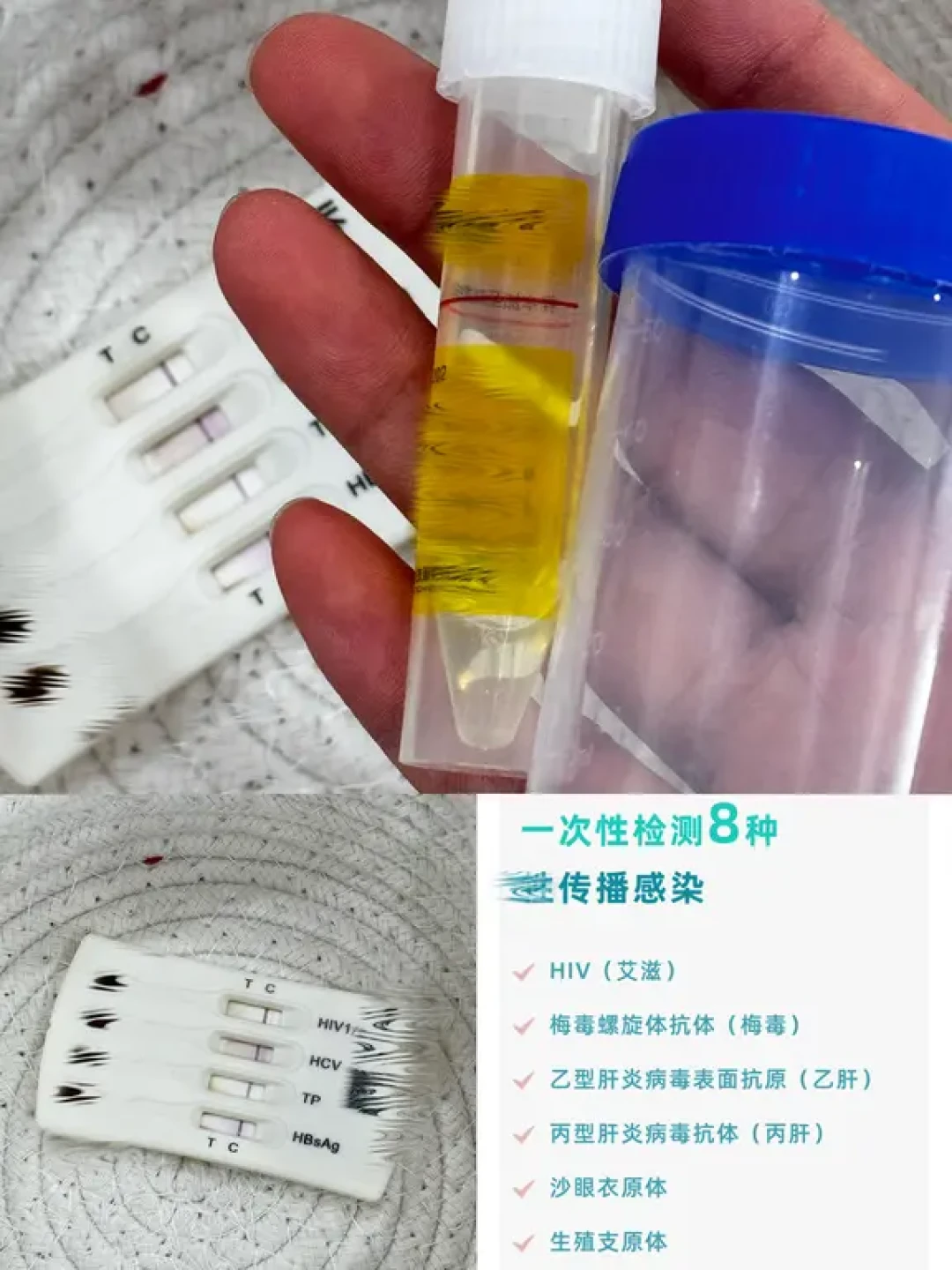 “传染病四项”里根本没有淋病和衣原体:同居前的“恋爱体检”,项目、科室、花费、窗口期一次讲清