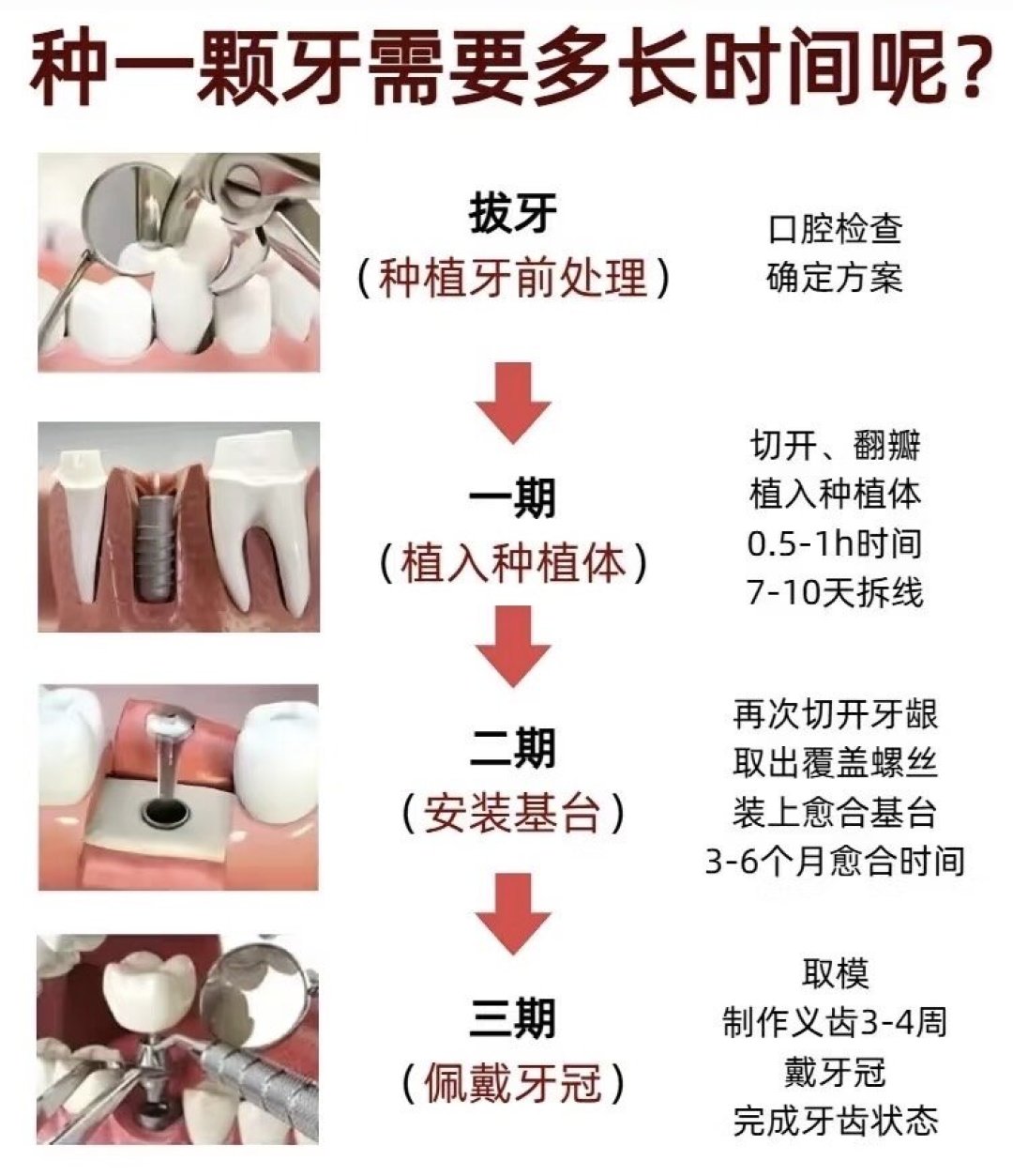 种牙公立医院3700元、诊所上万？对照集采中标价和各地真实账单，把差价和避坑清单一次算清