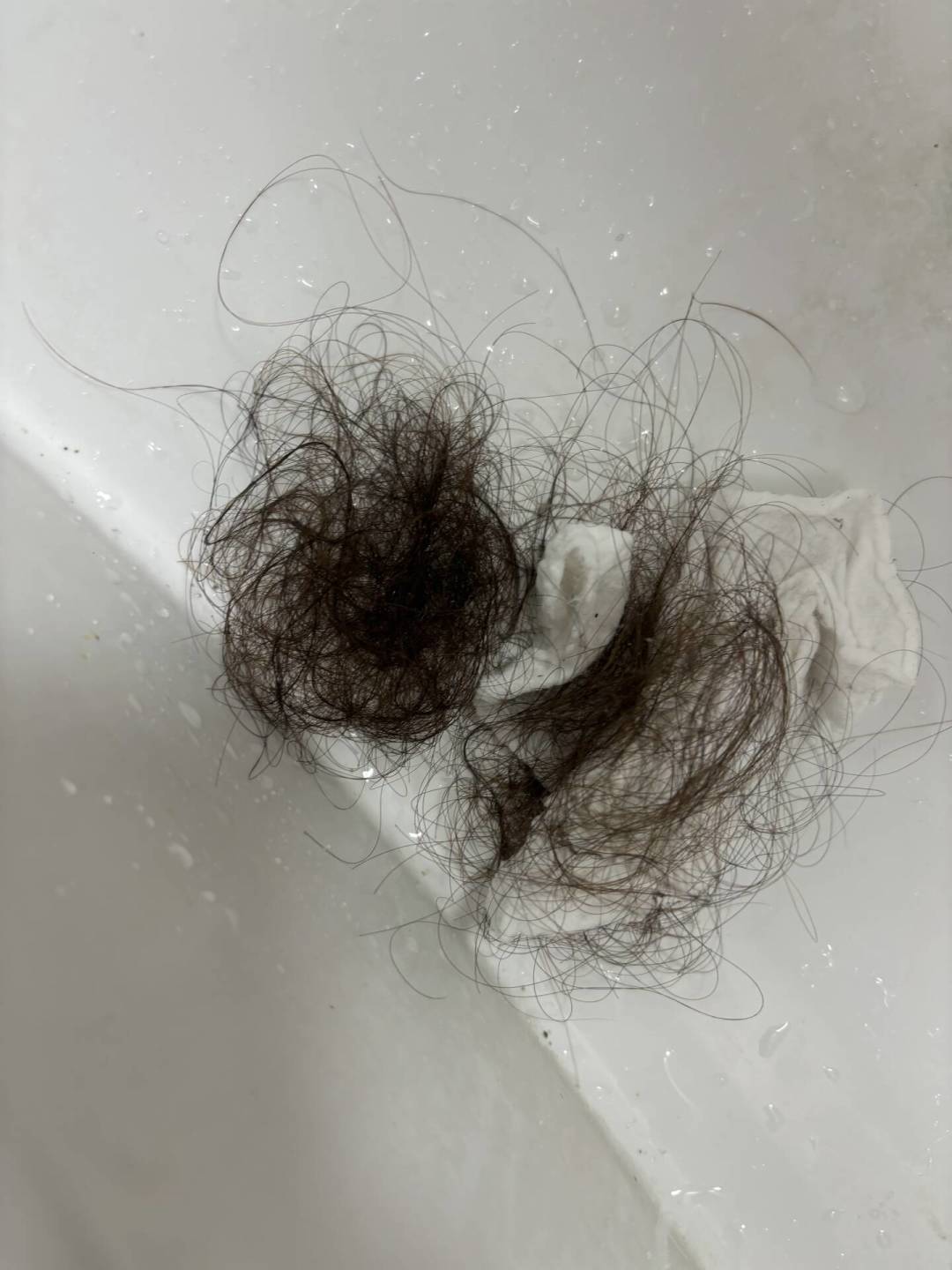 减肥三个月后头发一把把掉?这种脱发大多能自己长回来,先别急着买这4类产品
