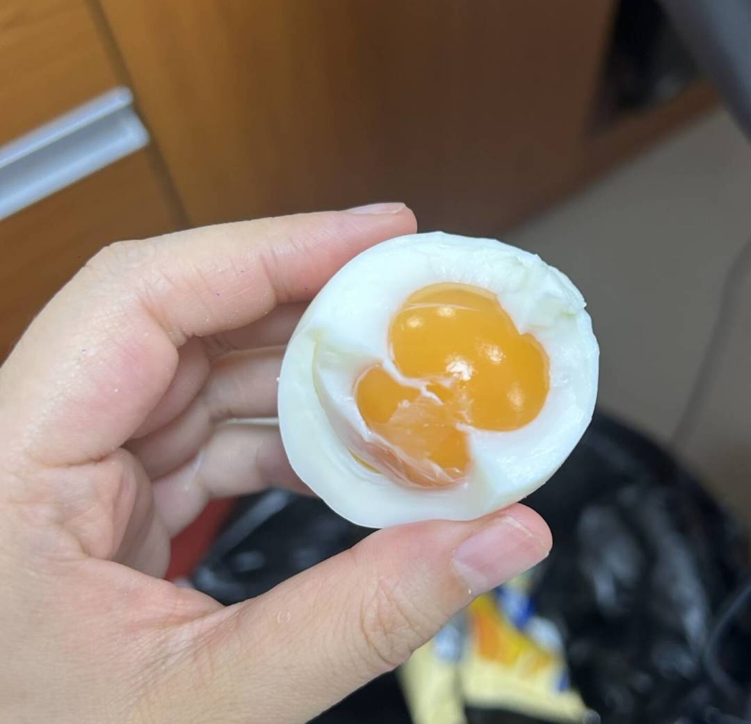 减肥三个月后头发一把把掉?这种脱发大多能自己长回来,先别急着买这4类产品