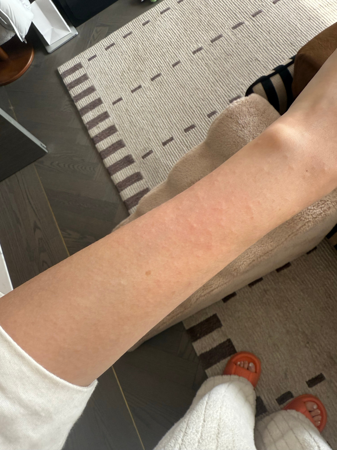 吸出来的大多不是活螨虫：秋季过敏季，除螨仪买前看懂3个真相和4个价位档