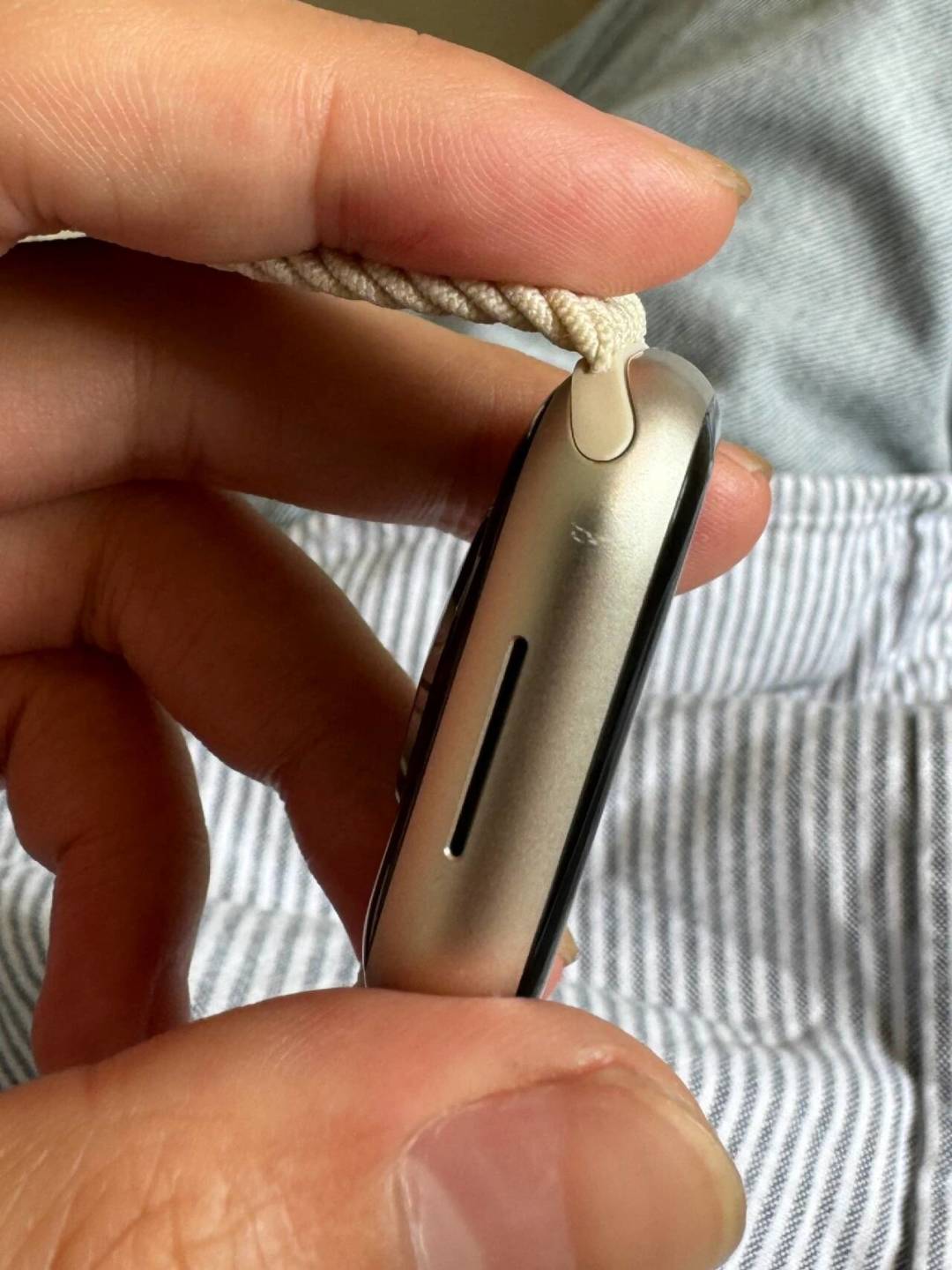 Apple Watch S10/S11掉漆,过保也能免费换新?我翻遍全网真实案例,讲清规则、流程和坑