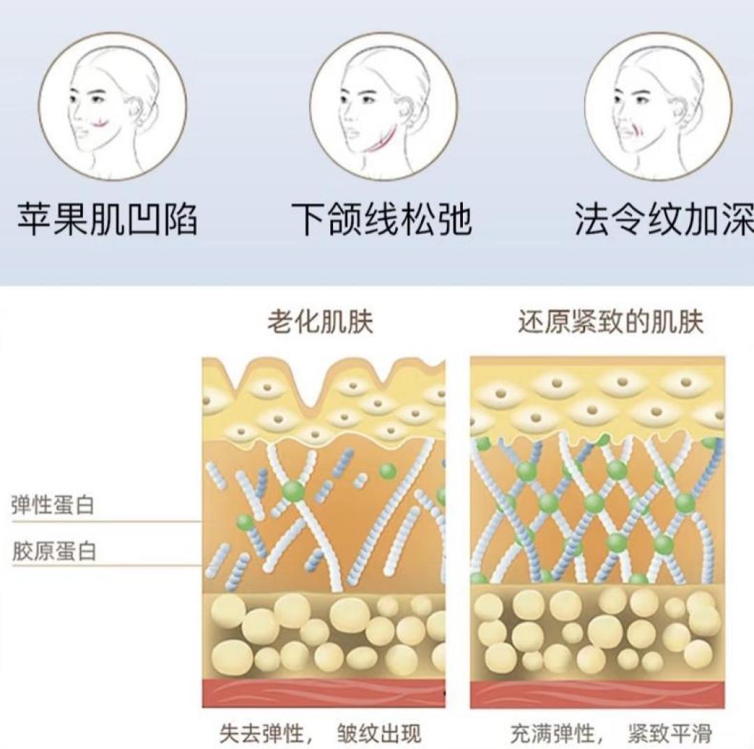 停下医美会老得更快?320万人围观的提问下,多位医生把6类热门项目停做后脸的真实变化说清楚了