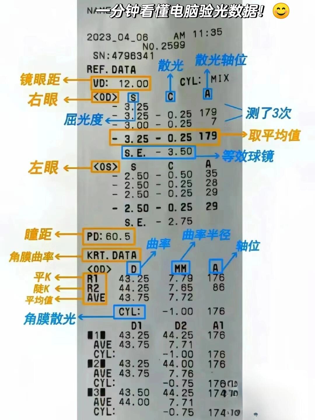 新版《近视防治指南》7月底刚印发,正赶上开学复查季:孩子近视防控的钱,从0元到3万,每一档该怎么花
