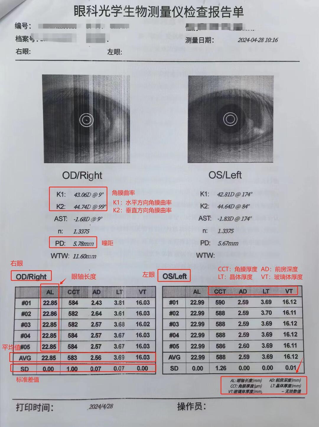 新版《近视防治指南》7月底刚印发,正赶上开学复查季:孩子近视防控的钱,从0元到3万,每一档该怎么花