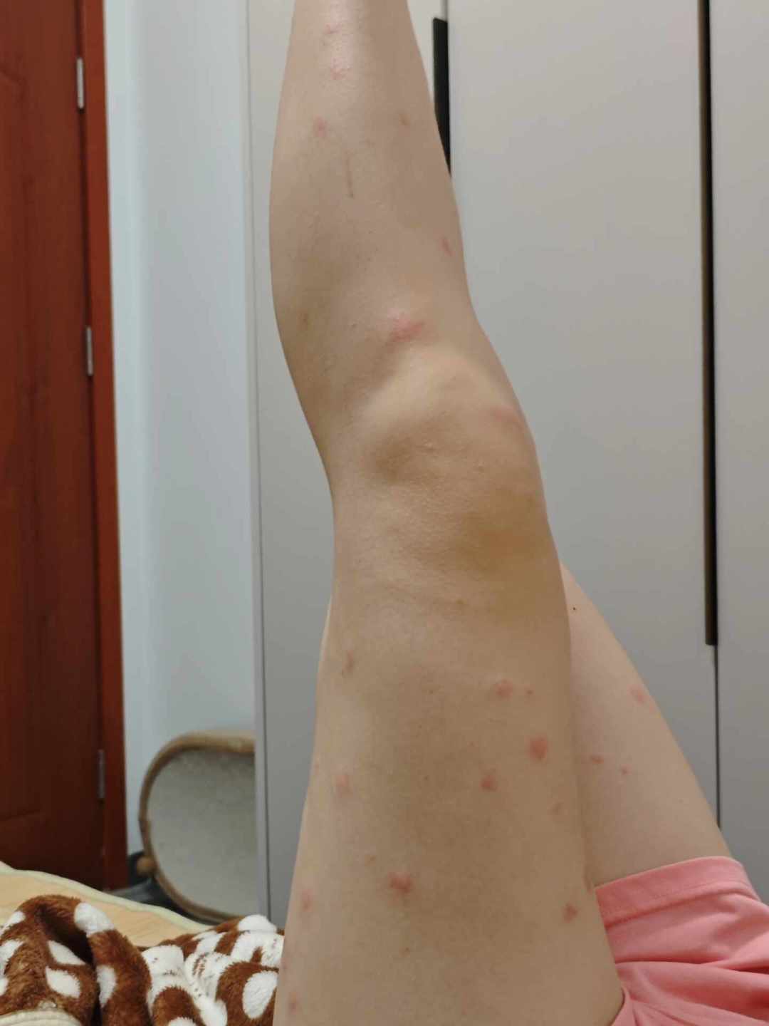 纱窗关着照样被咬醒?现在的蚊子比盛夏还凶,先查4个入口再买东西
