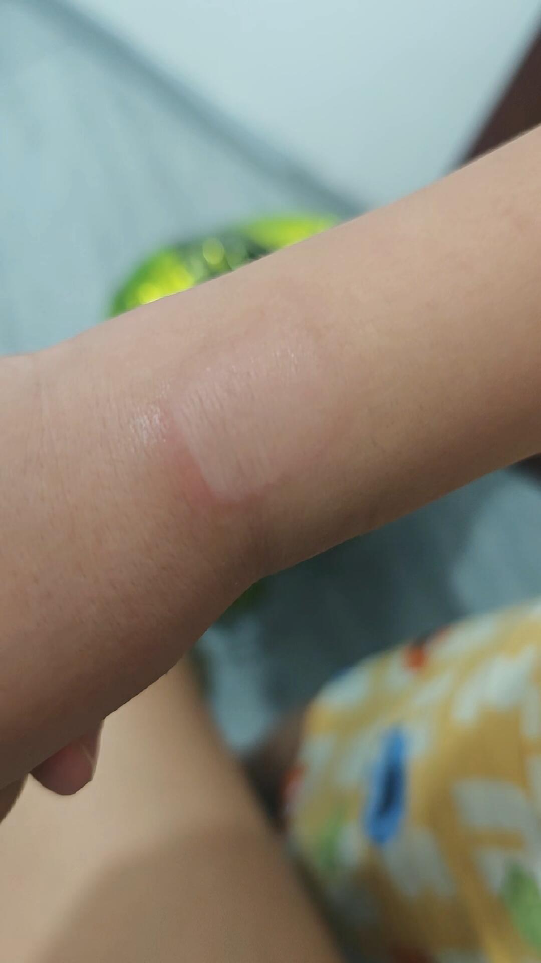 米兔手表又烫伤了孩子:翻完近两年的过热投诉,我整理出这份自查清单