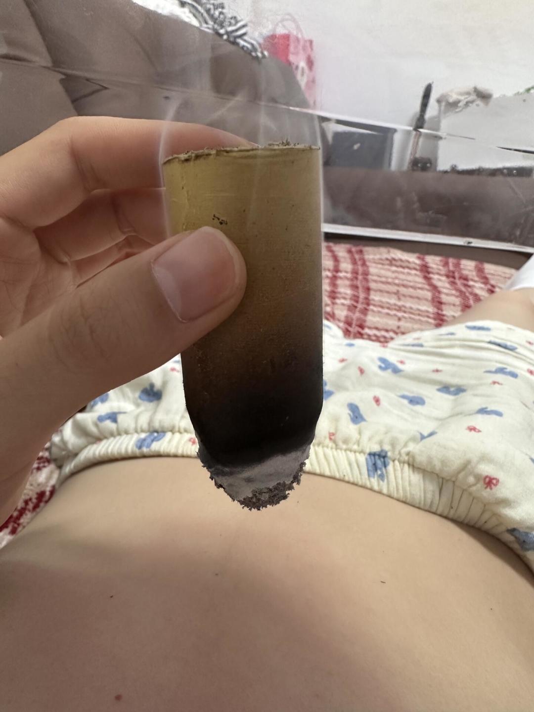 三伏只剩最后5天:三伏灸现在做还值不值?错过党的补救窗口、医院真实价格和智商税边界,一次说清
