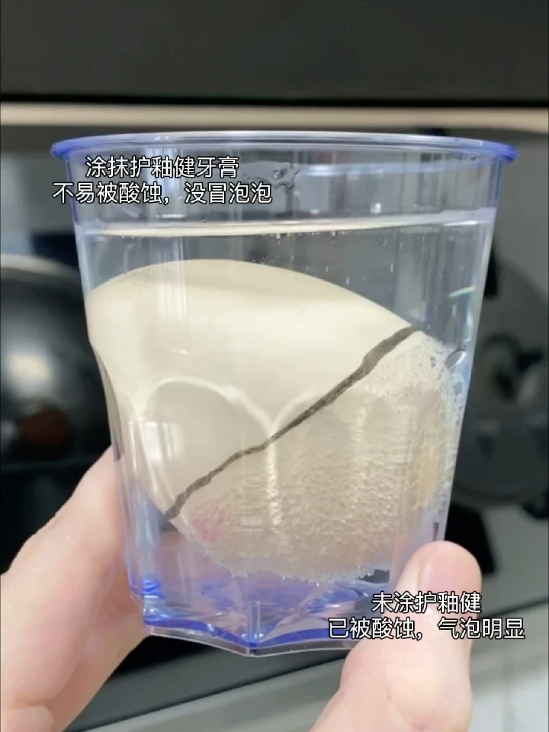 吃口冰淇淋就牙酸?我翻完全网几十篇近期牙敏感帖:抗敏牙膏3种情况管用,4种情况直接去医院