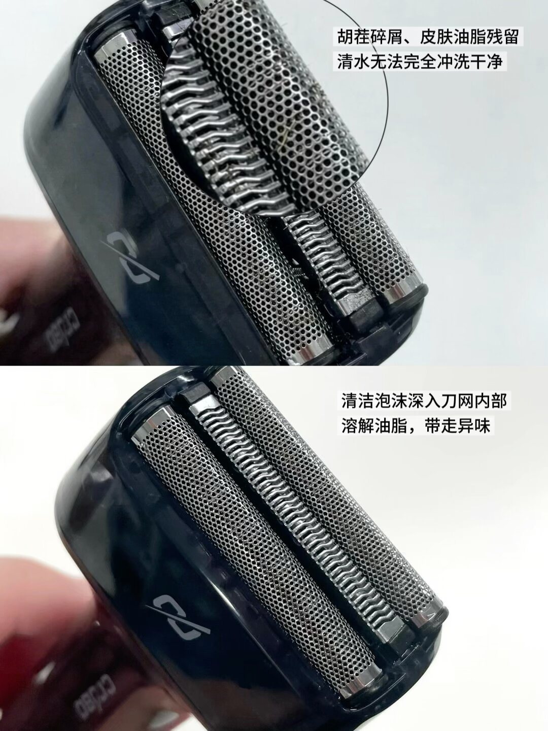 刮完胡子长的“痘”可能根本不是痘：翻完1.5万赞热帖和皮肤科文章，整理出3种原因自查表，对策从0元起