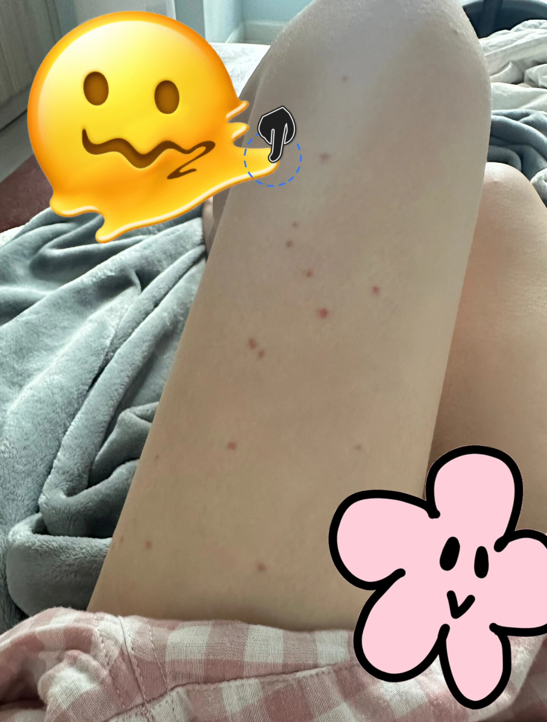 帐篷里被咬了一身包,别急着囤驱蚊喷雾:普通纱网连蠓虫都挡不住,4个漏洞逐个查