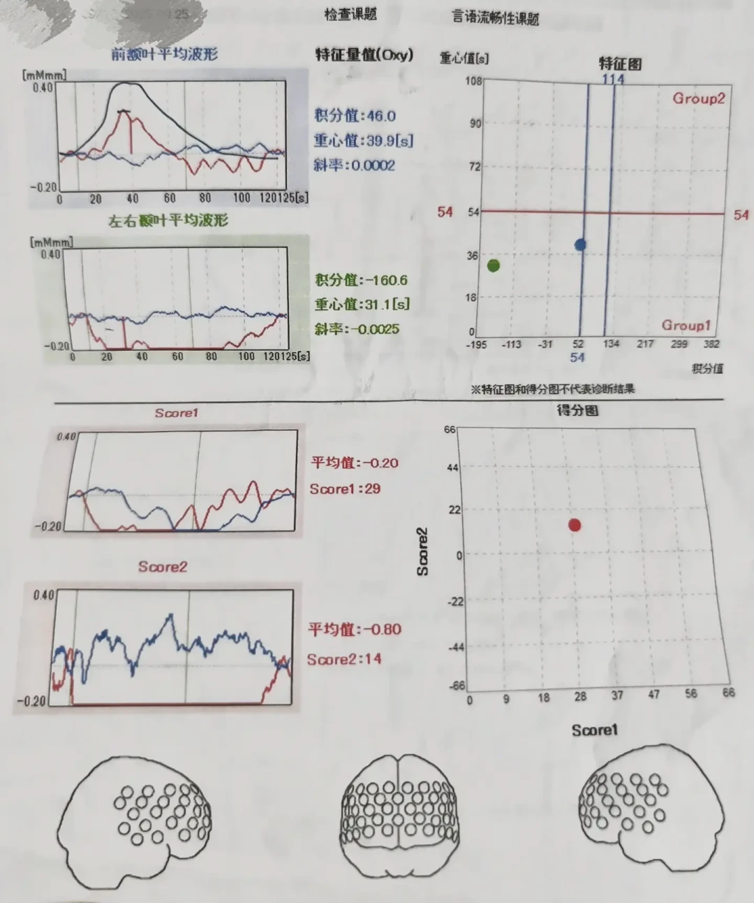 疑似ADHD，先别急着花钱确诊：三个问题筛掉